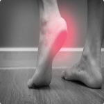3 Reasons Why Physical Therapy Often Successfully Treats Plantar Fasciitis